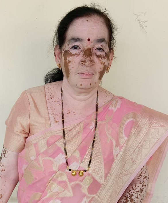Smt Nagamma Yeri
